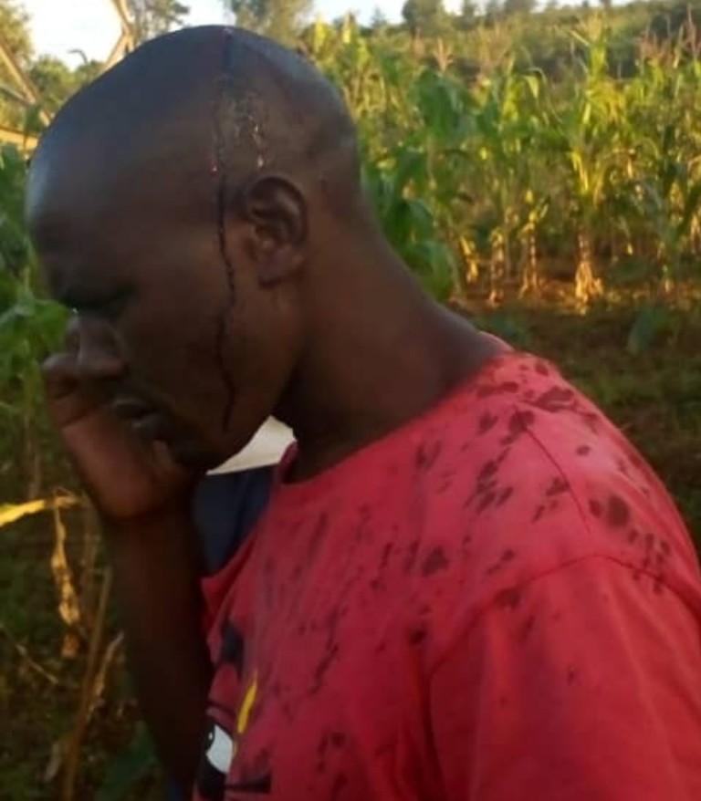 Gasabo: Umuturage yatemwe azizwa guha Polisi amakuru